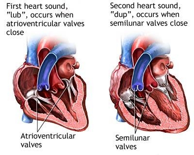 Insuficiente mitrale functionale - anatomia patologica